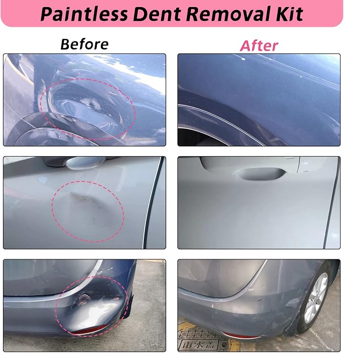 Car Dent Puller, 8 Packs Dent Remover Tool for Car Dent Repair, Versatile Suction Cups Puller with Strong Suction & Effortless Handle for Auto Body, Glass, Fridge, Tile Lifting & Objects Moving