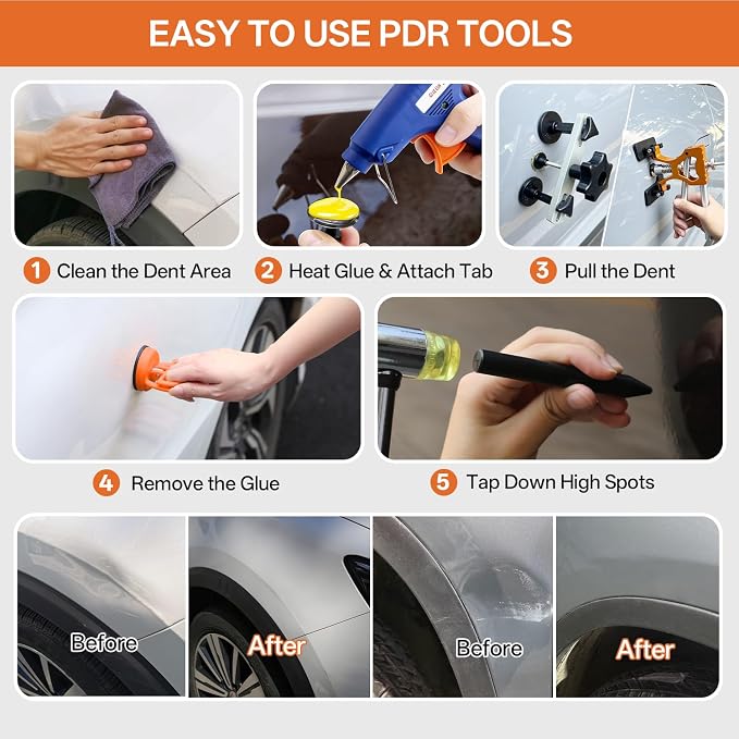 Paintless Dent Repair Kit for Car, PDR Dent Removal Tools with Dent Lifter & Pro Dent Puller Tabs, Auto Body Dent Puller for Car Dent Repair, Hail Damage Repair