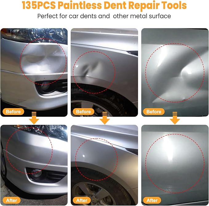 Sigoobal Car Dent Puller Kit, 135pcs Paintless Dent Removal Kit, Car Dent Repair Kit with Golden Lifter, Bridge Puller, Slide Hammer 2 in 1 T-Bar, Dent Puller for Car Refrigerator Door Ding Repair
