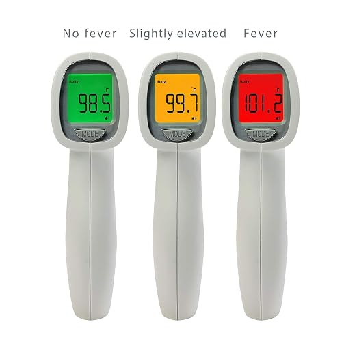 ADC Non-Contact Infrared Trigger-Style Screening Thermometer, Adtemp 433, White